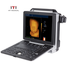 Clear Imaging Digital 4D Color Doppler Echocardiographie Cardiac USG Portable Ultrasound Machine